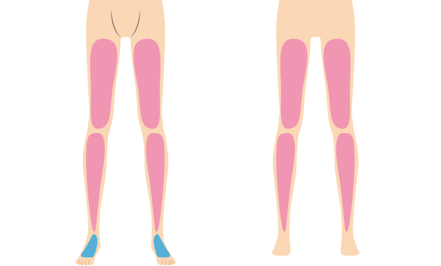 足全体脱毛のサービス
